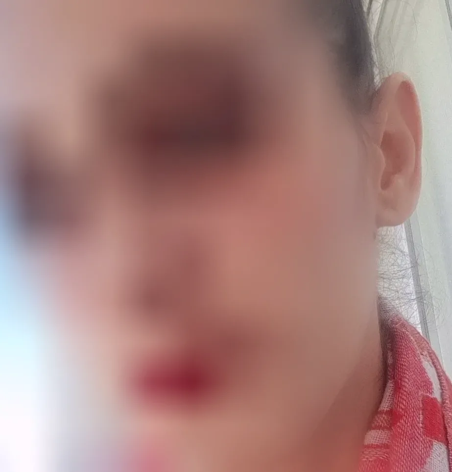 Elsa, 37 años